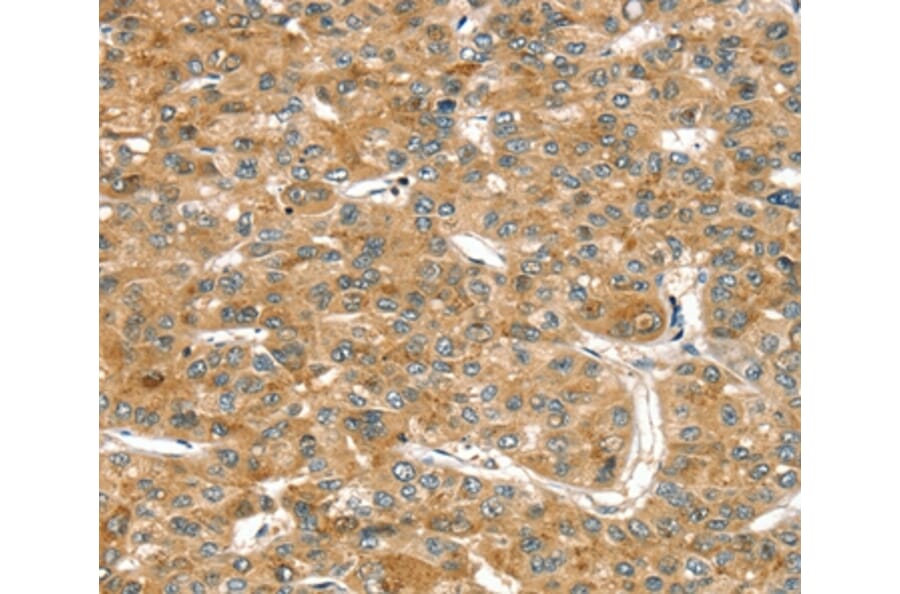 Immunohistochemistry - RASSF9 Antibody from Signalway Antibody (36714) - Antibodies.com