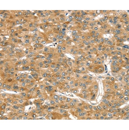 Immunohistochemistry - RASSF9 Antibody from Signalway Antibody (36714) - Antibodies.com