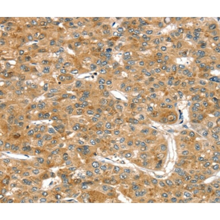 Immunohistochemistry - RASSF9 Antibody from Signalway Antibody (36714) - Antibodies.com