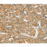 Immunohistochemistry - RASSF9 Antibody from Signalway Antibody (36714) - Antibodies.com