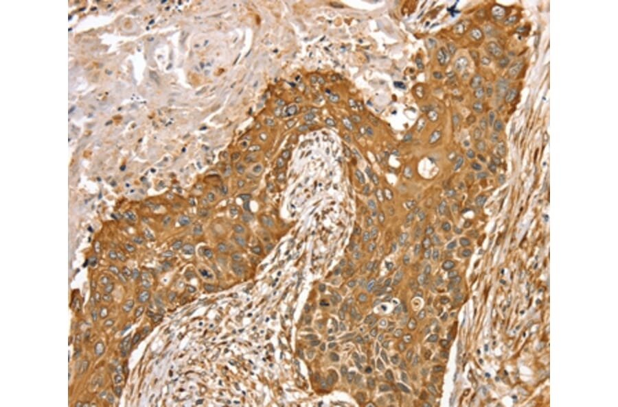 Immunohistochemistry - RASSF9 Antibody from Signalway Antibody (36714) - Antibodies.com
