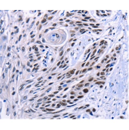 Immunohistochemistry - CREBBP Antibody from Signalway Antibody (36778) - Antibodies.com