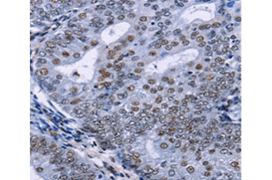Immunohistochemistry - CREBBP Antibody from Signalway Antibody (36778) - Antibodies.com