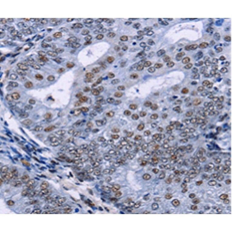 Immunohistochemistry - CREBBP Antibody from Signalway Antibody (36778) - Antibodies.com