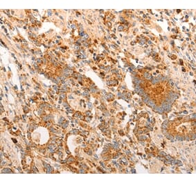 Immunohistochemistry - CDKN1C Antibody from Signalway Antibody (36788) - Antibodies.com