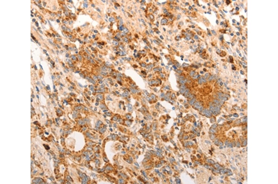 Immunohistochemistry - CDKN1C Antibody from Signalway Antibody (36788) - Antibodies.com