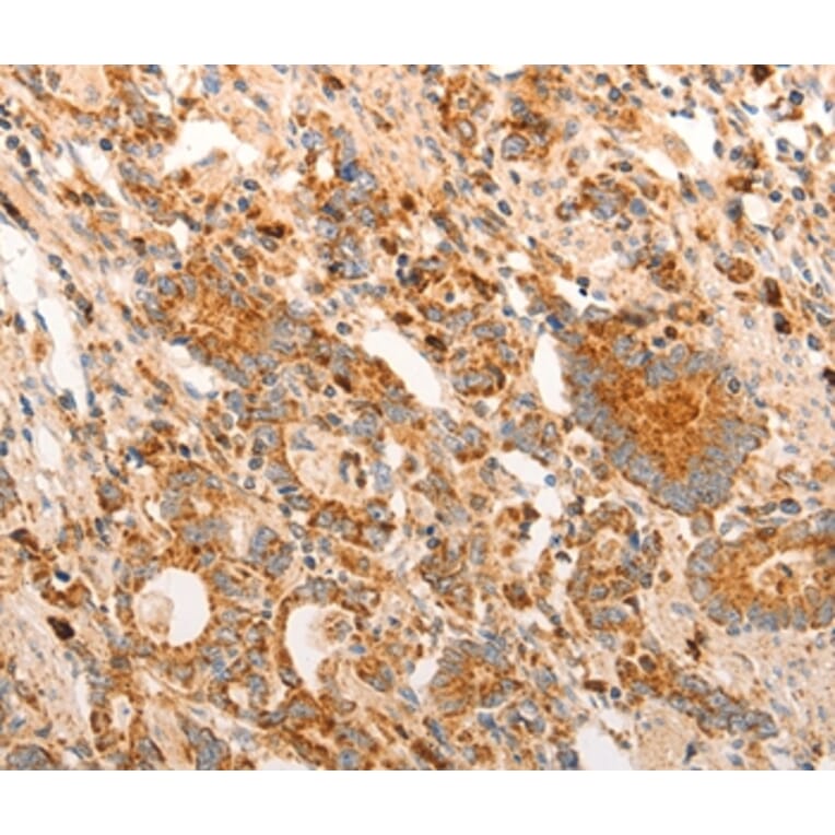 Immunohistochemistry - CDKN1C Antibody from Signalway Antibody (36788) - Antibodies.com