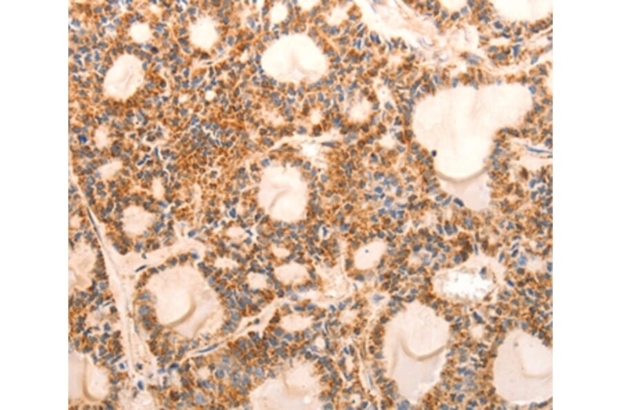 Immunohistochemistry - CDKN1C Antibody from Signalway Antibody (36788) - Antibodies.com