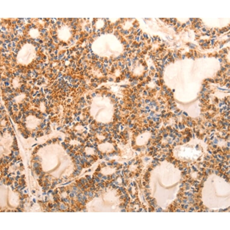 Immunohistochemistry - CDKN1C Antibody from Signalway Antibody (36788) - Antibodies.com