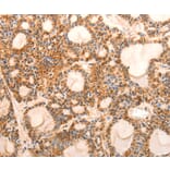 Immunohistochemistry - CDKN1C Antibody from Signalway Antibody (36788) - Antibodies.com
