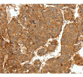 Immunohistochemistry - COL4A1 Antibody from Signalway Antibody (36803) - Antibodies.com