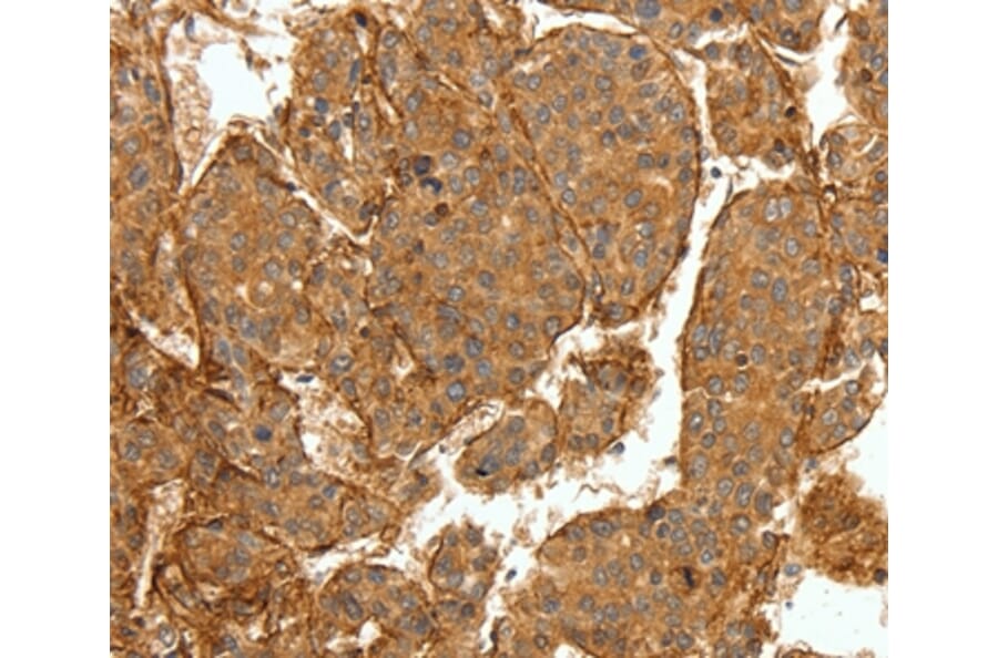 Immunohistochemistry - COL4A1 Antibody from Signalway Antibody (36803) - Antibodies.com