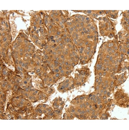 Immunohistochemistry - COL4A1 Antibody from Signalway Antibody (36803) - Antibodies.com