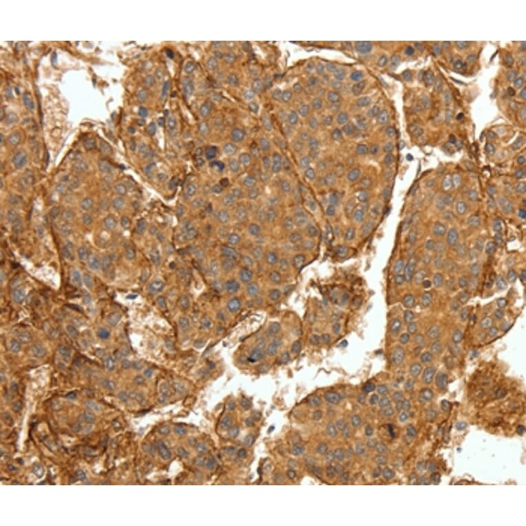 Immunohistochemistry - COL4A1 Antibody from Signalway Antibody (36803) - Antibodies.com