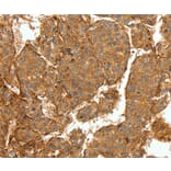 Immunohistochemistry - COL4A1 Antibody from Signalway Antibody (36803) - Antibodies.com