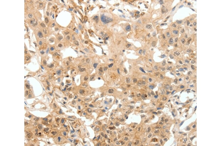 Immunohistochemistry - COL4A1 Antibody from Signalway Antibody (36803) - Antibodies.com