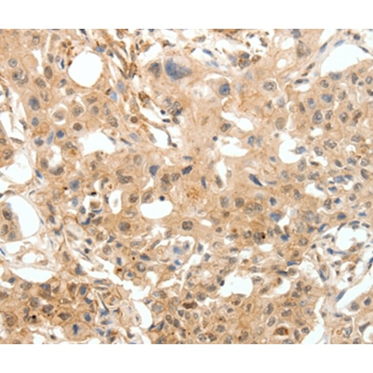 Immunohistochemistry - COL4A1 Antibody from Signalway Antibody (36803) - Antibodies.com