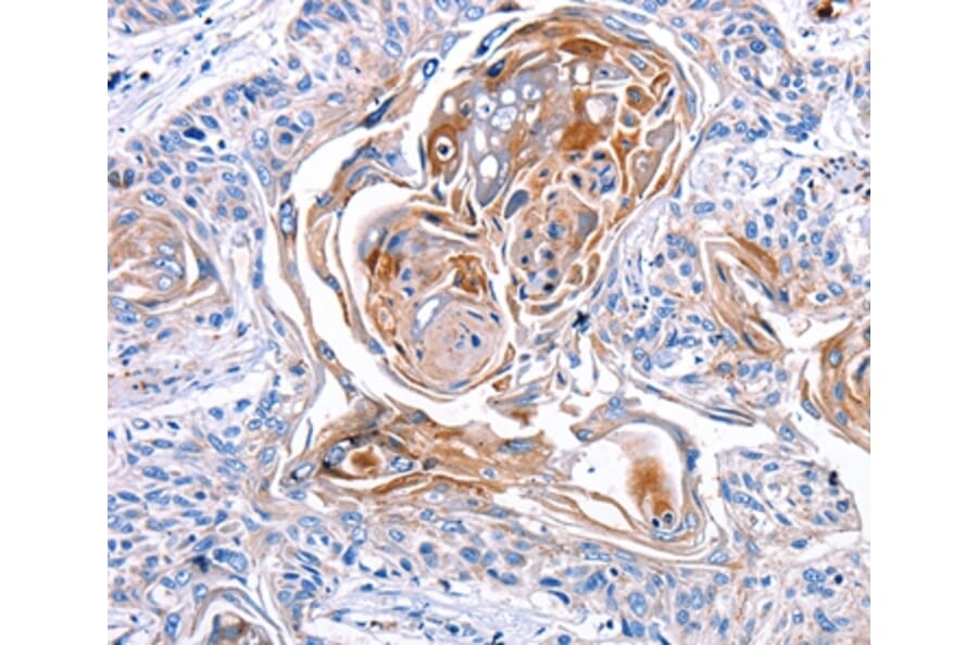 Immunohistochemistry - CX3CL1 Antibody from Signalway Antibody (36816) - Antibodies.com