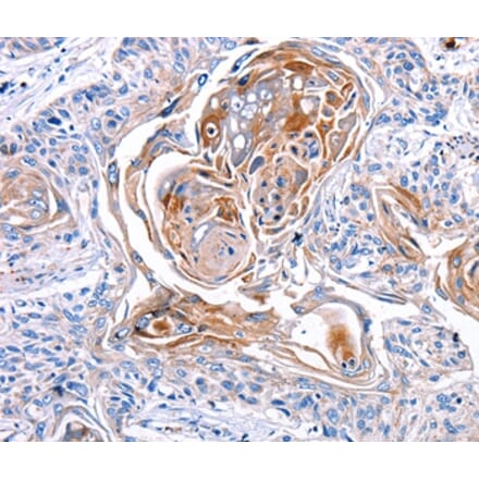 Immunohistochemistry - CX3CL1 Antibody from Signalway Antibody (36816) - Antibodies.com