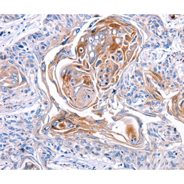 Immunohistochemistry - CX3CL1 Antibody from Signalway Antibody (36816) - Antibodies.com