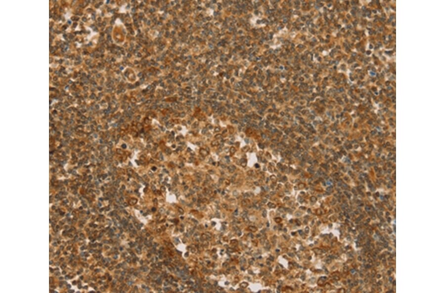 Immunohistochemistry - SLC6A3 Antibody from Signalway Antibody (36823) - Antibodies.com