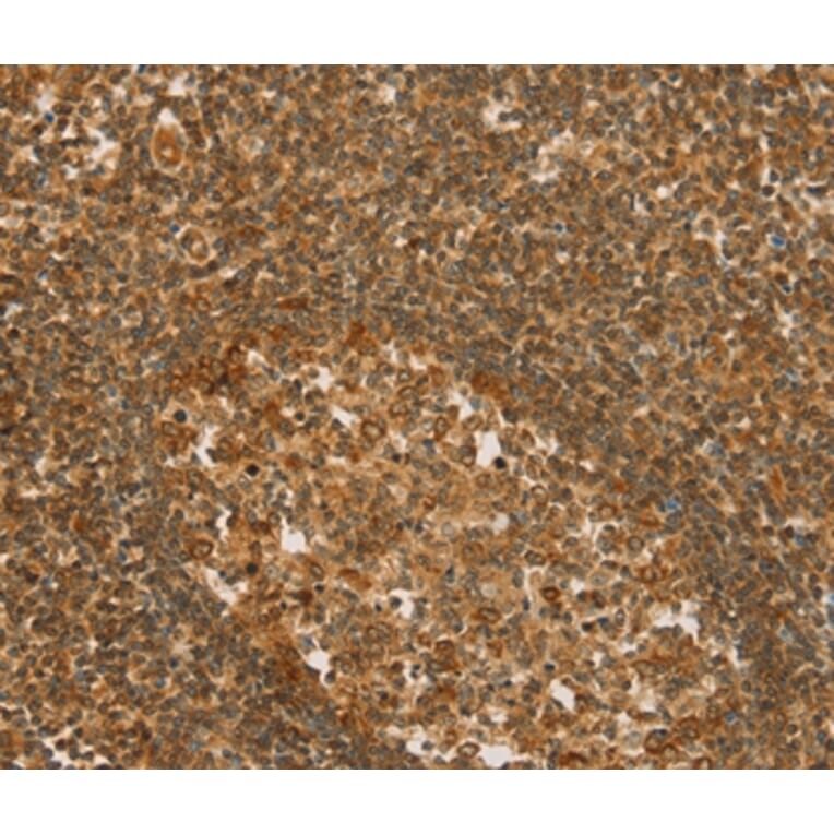 Immunohistochemistry - SLC6A3 Antibody from Signalway Antibody (36823) - Antibodies.com