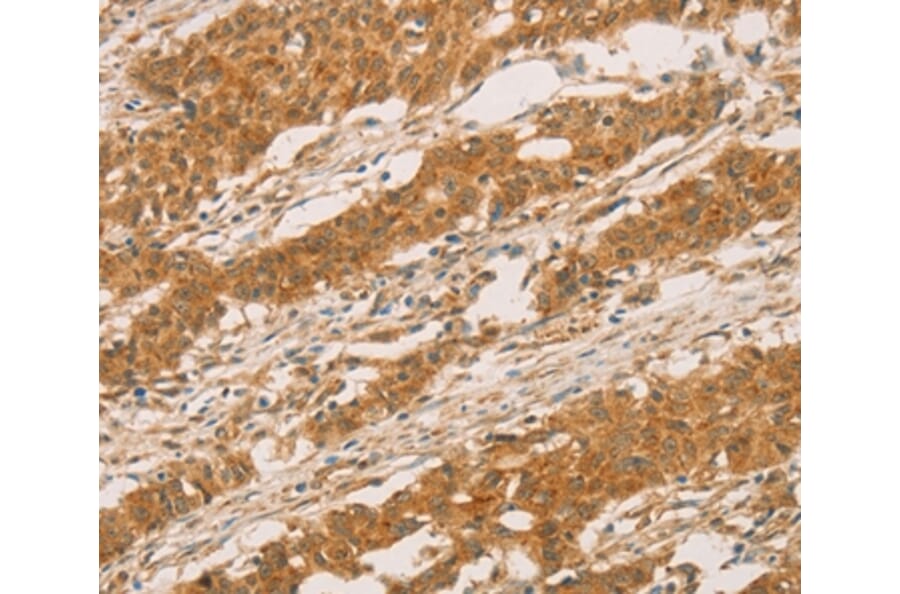 Immunohistochemistry - SLC6A3 Antibody from Signalway Antibody (36823) - Antibodies.com