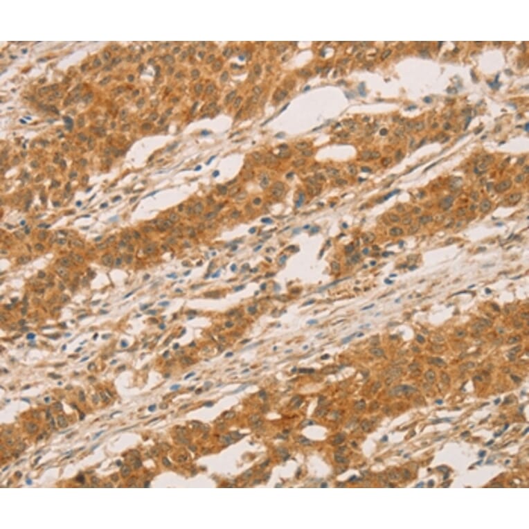Immunohistochemistry - SLC6A3 Antibody from Signalway Antibody (36823) - Antibodies.com