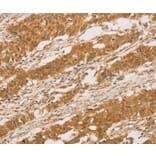 Immunohistochemistry - SLC6A3 Antibody from Signalway Antibody (36823) - Antibodies.com