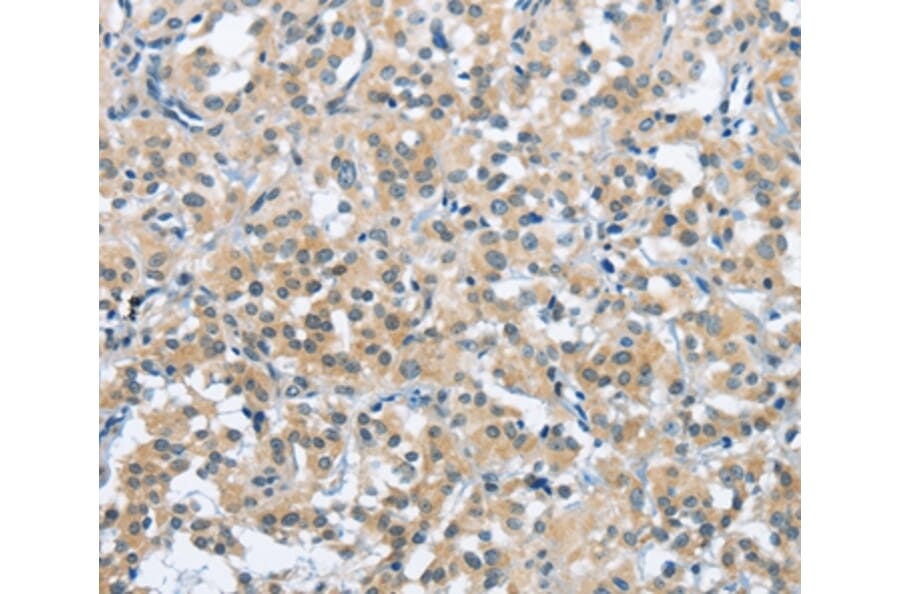 Immunohistochemistry - TRDMT1 Antibody from Signalway Antibody (36827) - Antibodies.com