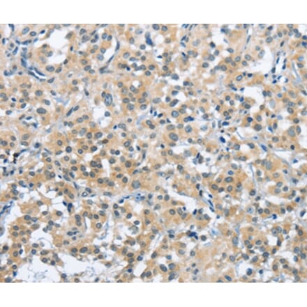 Immunohistochemistry - TRDMT1 Antibody from Signalway Antibody (36827) - Antibodies.com