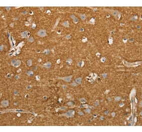 Immunohistochemistry - SLC1A2 Antibody from Signalway Antibody (36832) - Antibodies.com