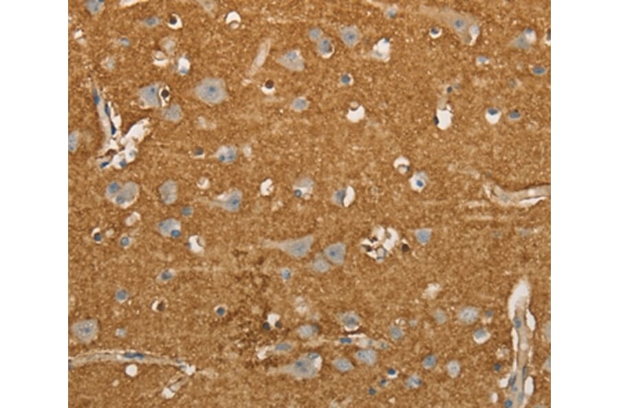 Immunohistochemistry - SLC1A2 Antibody from Signalway Antibody (36832) - Antibodies.com