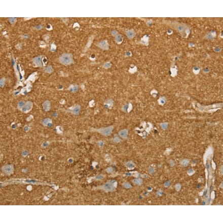 Immunohistochemistry - SLC1A2 Antibody from Signalway Antibody (36832) - Antibodies.com