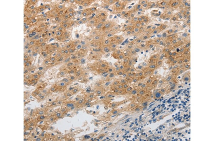Immunohistochemistry - SLC1A2 Antibody from Signalway Antibody (36832) - Antibodies.com