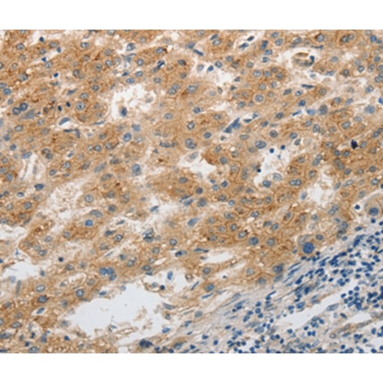 Immunohistochemistry - SLC1A2 Antibody from Signalway Antibody (36832) - Antibodies.com