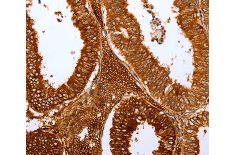 Immunohistochemistry - FOXN1 Antibody from Signalway Antibody (36869) - Antibodies.com