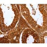 Immunohistochemistry - FOXN1 Antibody from Signalway Antibody (36869) - Antibodies.com