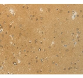 Immunohistochemistry - SLC9A3 Antibody from Signalway Antibody (36875) - Antibodies.com