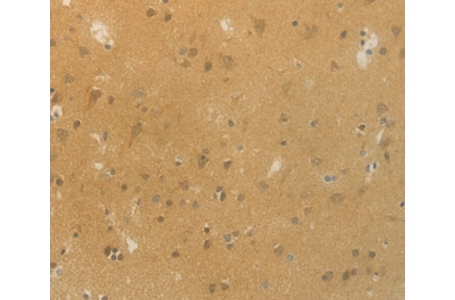 Immunohistochemistry - SLC9A3 Antibody from Signalway Antibody (36875) - Antibodies.com