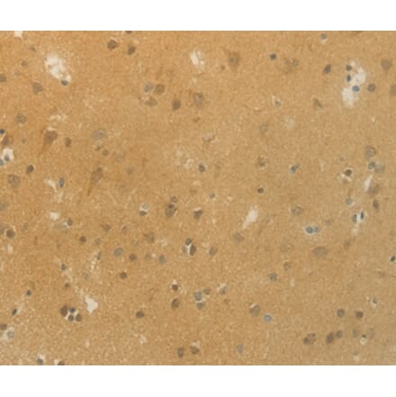 Immunohistochemistry - SLC9A3 Antibody from Signalway Antibody (36875) - Antibodies.com