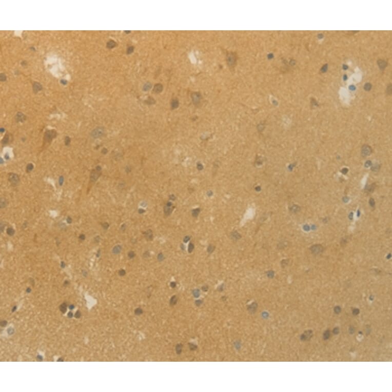Immunohistochemistry - SLC9A3 Antibody from Signalway Antibody (36875) - Antibodies.com