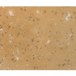 Immunohistochemistry - SLC9A3 Antibody from Signalway Antibody (36875) - Antibodies.com