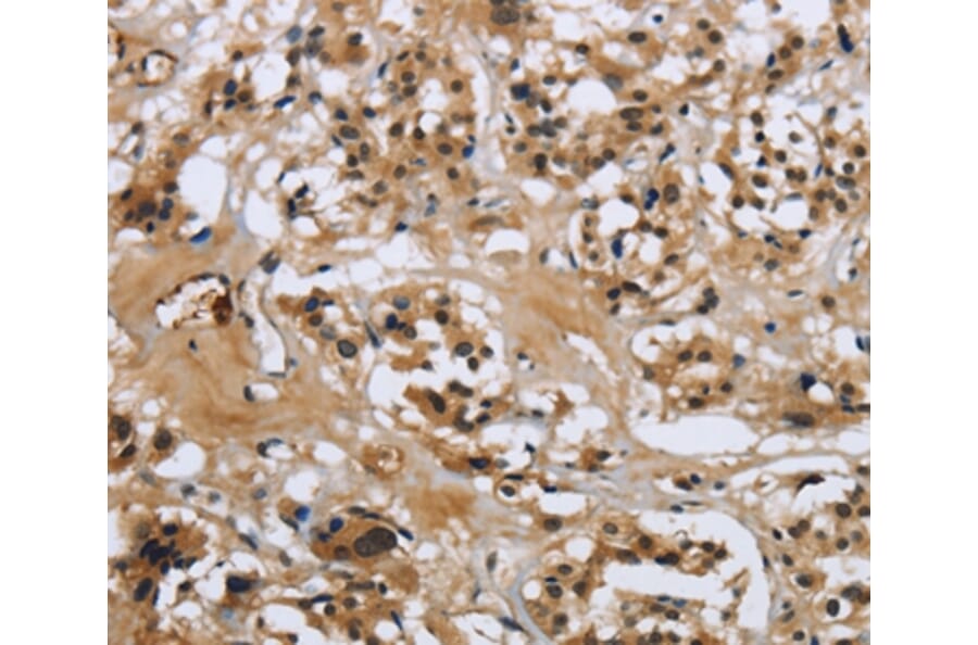 Immunohistochemistry - LGALS7 Antibody from Signalway Antibody (36880) - Antibodies.com