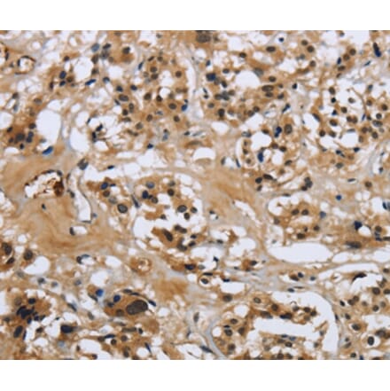 Immunohistochemistry - LGALS7 Antibody from Signalway Antibody (36880) - Antibodies.com