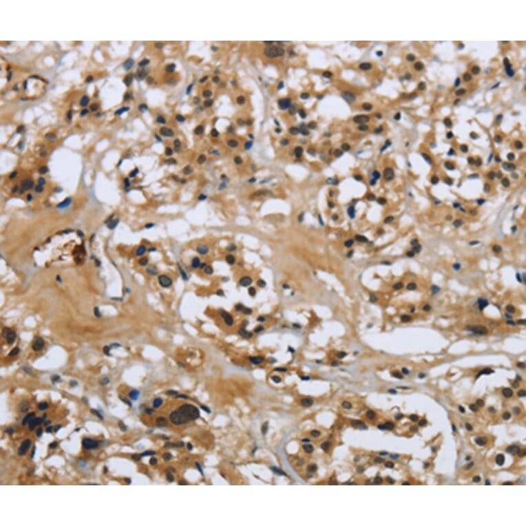 Immunohistochemistry - LGALS7 Antibody from Signalway Antibody (36880) - Antibodies.com