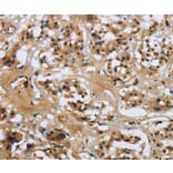 Immunohistochemistry - LGALS7 Antibody from Signalway Antibody (36880) - Antibodies.com