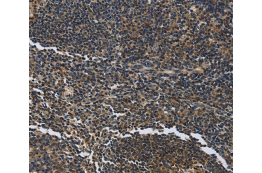 Immunohistochemistry - LGALS7 Antibody from Signalway Antibody (36880) - Antibodies.com