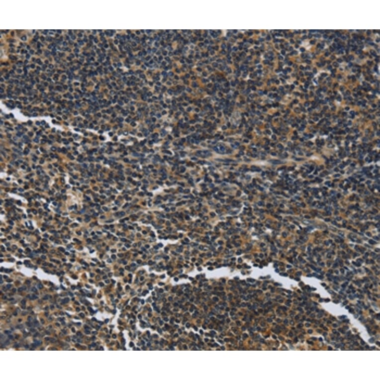 Immunohistochemistry - LGALS7 Antibody from Signalway Antibody (36880) - Antibodies.com