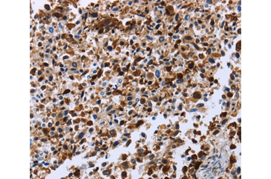 Immunohistochemistry - CXCR3 Antibody from Signalway Antibody (36881) - Antibodies.com